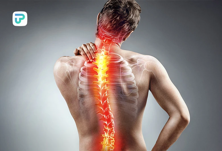 قویترین شیاف برای کمر درد مناسب است|توان مارکت