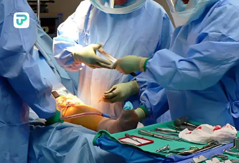 تجربیات عمل پای پرانتزی و درمان پای پرانتزی با لیزر | توان مارکت