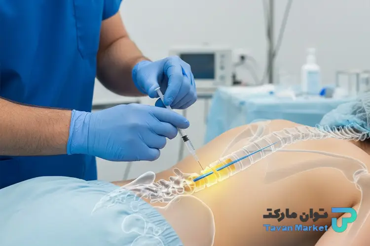 تزریق دارو برای تنگی کانال نخاعی