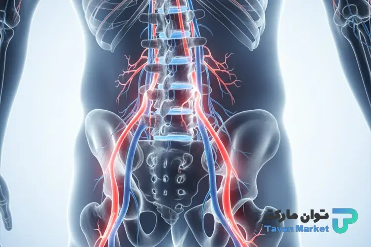 عوارض عدم درمان تنگی کانال نخاعی