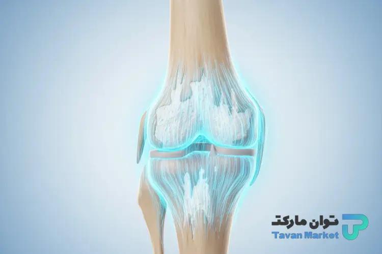 پمادهای غضروف‌ساز زانو