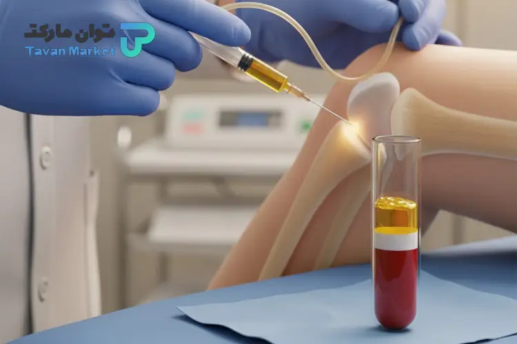 پی آر پی زانو