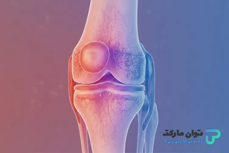 آمپول بتامتازون برای چی خوبه